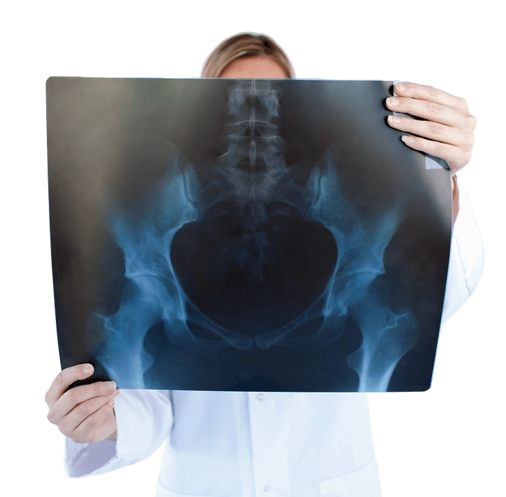 доктор рассматривает рентгеновский снимок таза